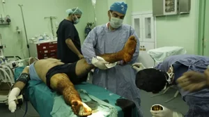 Doctor Ghassan Abu Sitta (R) and other doctors treat a patient suffering from severe burns in Gaza